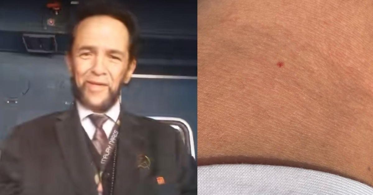 “Wolverine”, Director Del Metro, DA 3 Claves para Actuar ante Pinchazos en la Cdmx