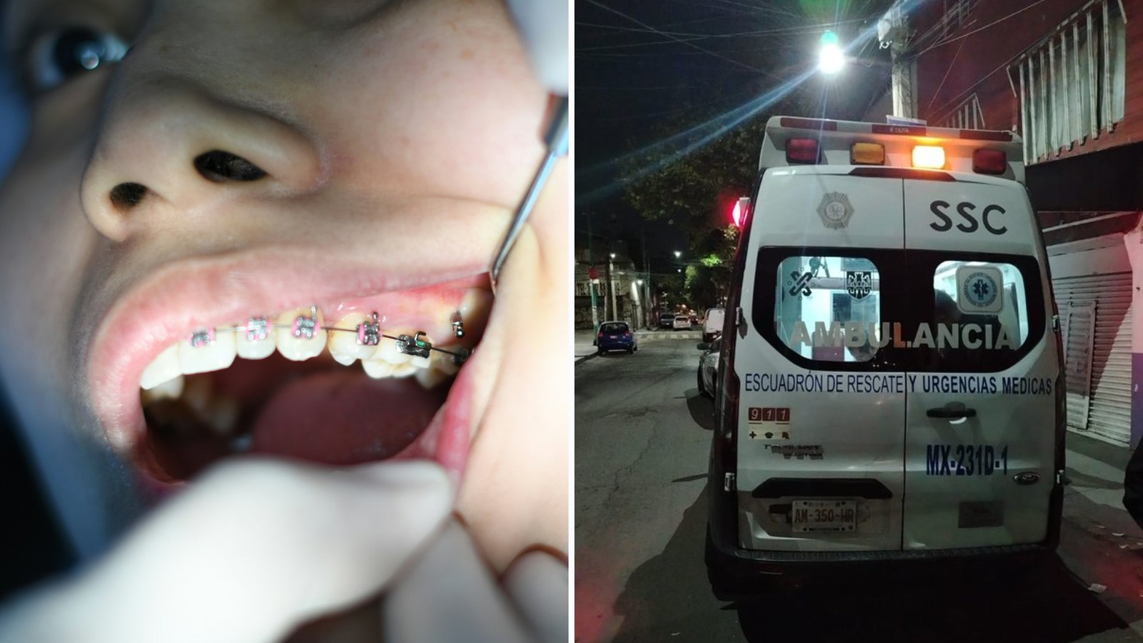 Joven Le Corta Por Error los genitales A Su Novio Con sus Brackets en Cdmx
