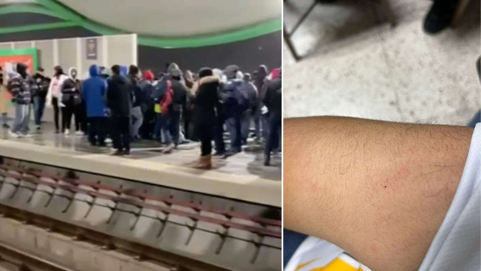 Reportan Segundo Pinchazo en Metro de Monterrey; Este Sabemos del Caso