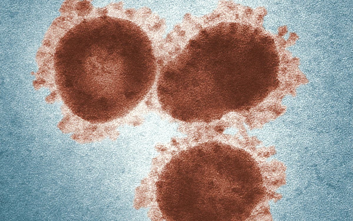 México Acumula 4 Muertos por Sarampión; Reportan Más de 1.600 CASOS ESTE 2025