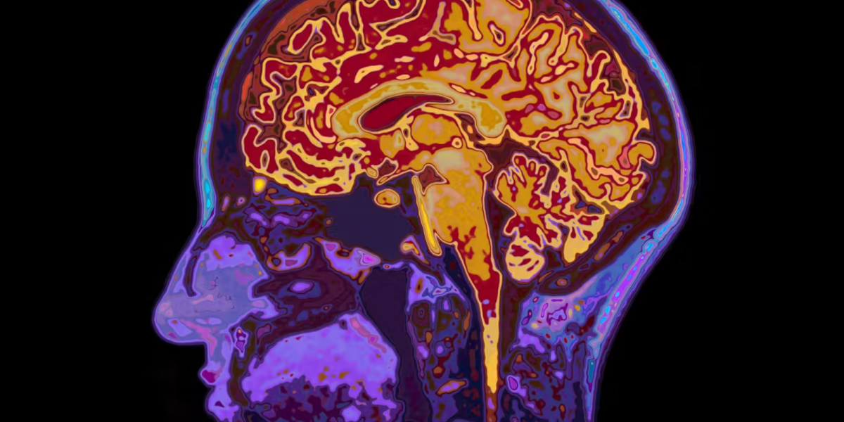 ¿Qé Pasa en el Cerebro Cuando “Caemos en la tentacia”? Neurociencia de la Corrupción Política